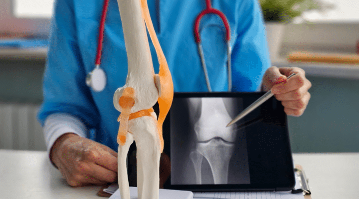 How Physical Therapy Can Help with Recovery from Knee Replacement