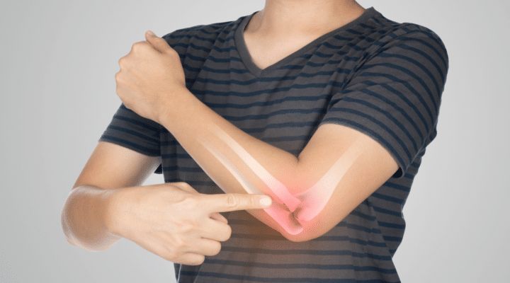 Overcoming Tennis Elbow: Physical Therapy Techniques to Reduce Pain