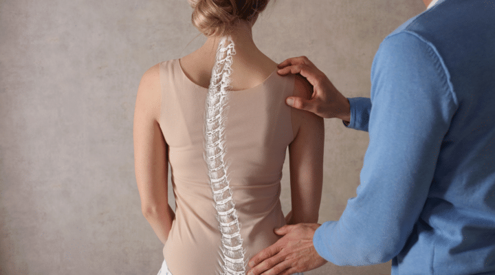 Scoliosis Spine Curve Anatomy, Posture Correction.