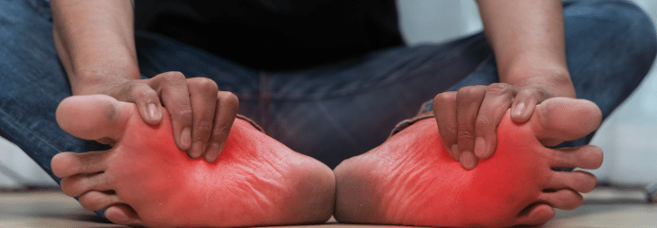 Plantar Fasciitis: Symptoms, Causes & Treatment Options: Swollen feet showing symptoms of plantar fasciitis