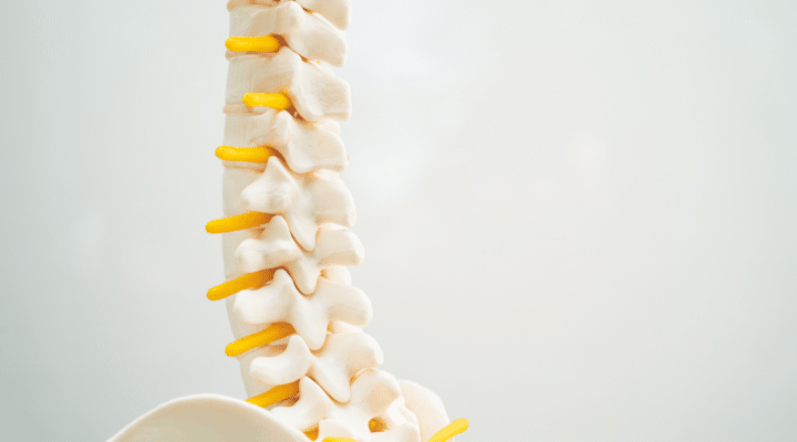 The Evaluation and Treatment of Herniated Discs